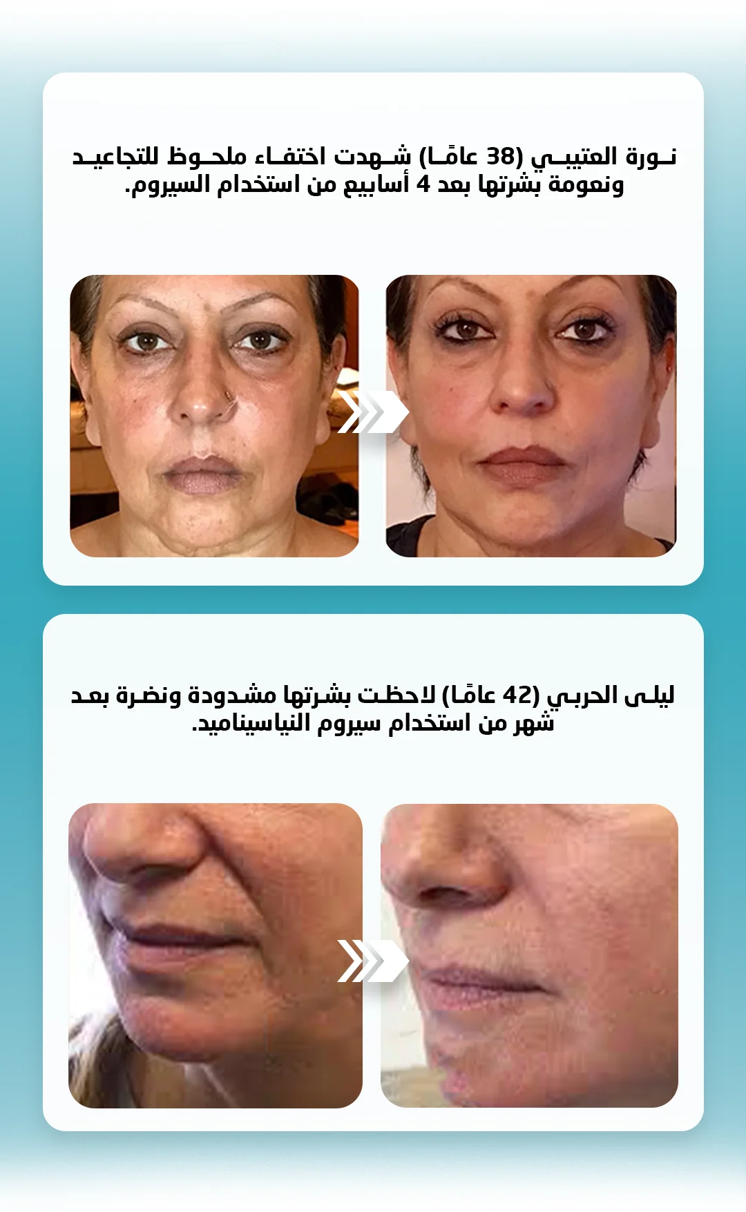 39fde45c-a347-42cf-bcfa-d391f6a68e68.f53d7381-e3fc-4127-84c0-7a902d0b28f2.niacinamide-6