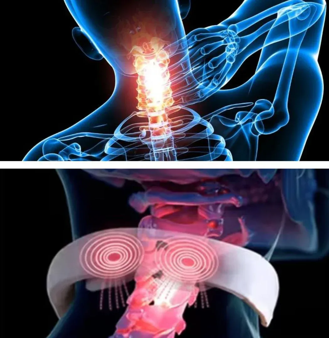 Masseur de cou intelligent avec technologie à impulsions électriques B397aff7 A865 4581 9dc4 Db996f83260b.imgi 34 Infograms