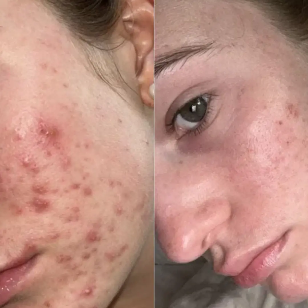 f2e1aa33-414e-4354-82b6-beab64523bff.article1 korenet banners poc