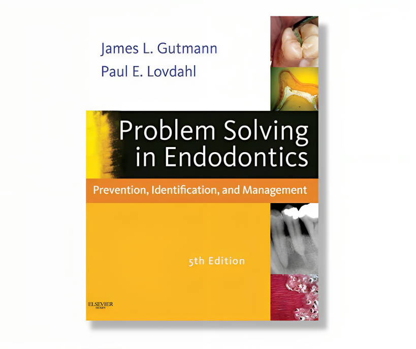problem solving in endodontics prevention identification and management