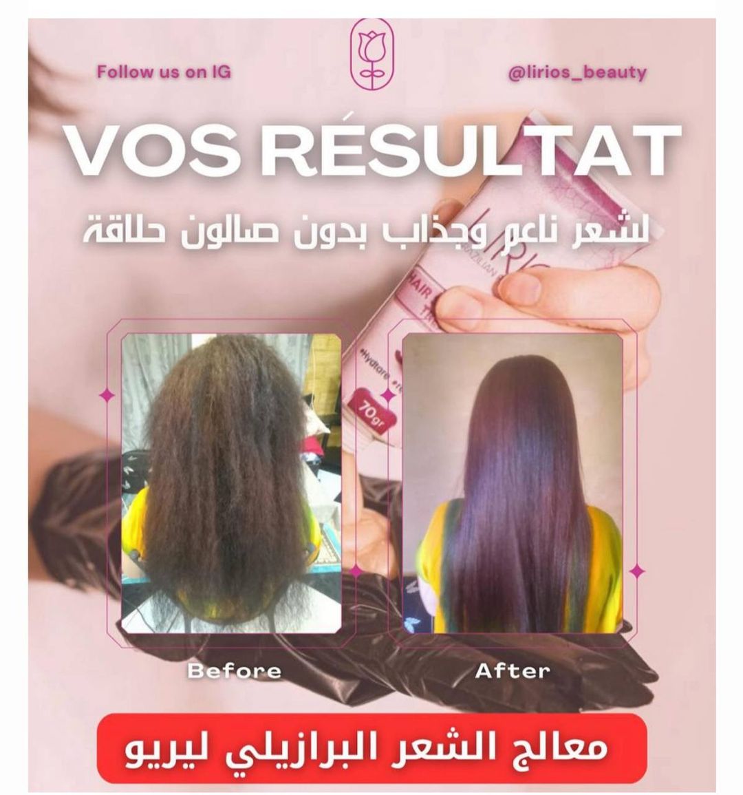 b4d4c7cf-d31e-475e-90ea-f589ef31843e.phot2