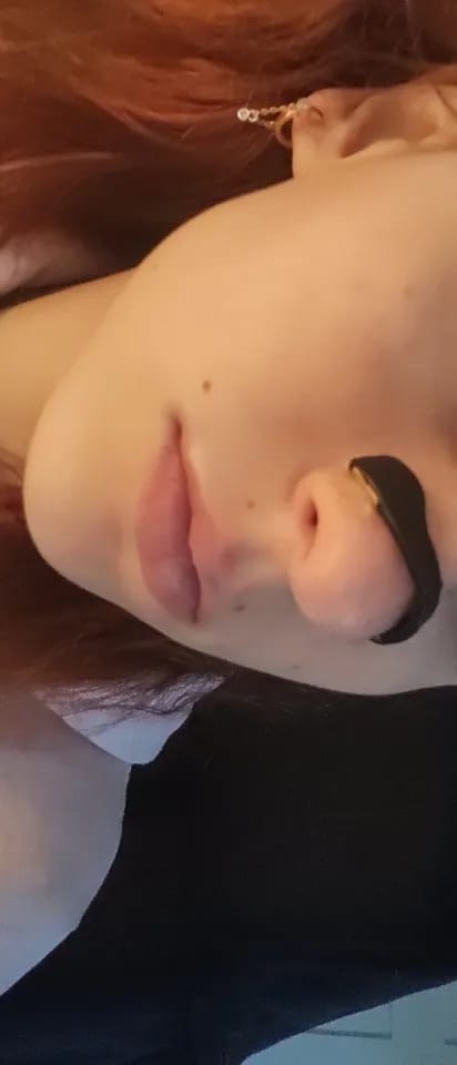 Testimonio comodidad dilatador nasal