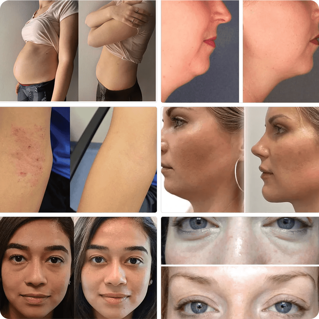 93f6b06b-a047-4868-a7eb-831c7c2b59d5.imgi_92_before-min_png