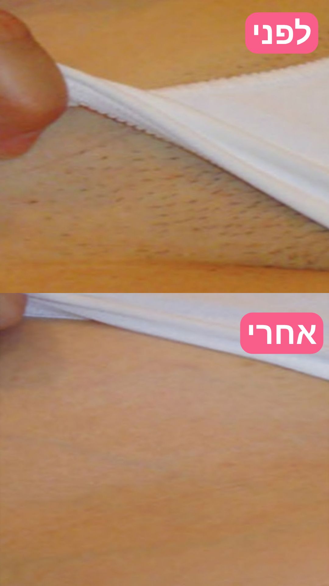 EpiLa, EpiLa.co.ul, ערכה להסרת שיער, הסרת שיער