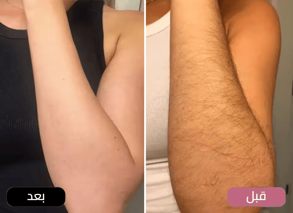 3615c02b-f8e5-4c8b-a8ef-120d5c838867.950e54cf-7428-4ad8-b1c5-25334897bb16.armsba